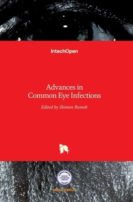 Advances in Common Eye Infections by Rumelt, Shimon