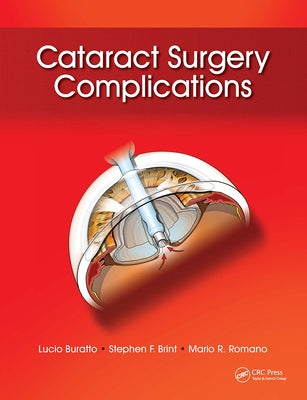 Cataract Surgery Complications by Buratto, Lucio