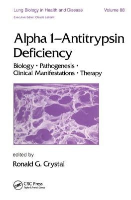 Alpha 1 - Antitrypsin Deficiency: Biology-Pathogenesis-Clinical Manifestations-Therapy by Crystal, Ronald G.