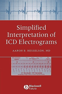 Simplified Interpretation of ICD Electrograms by Hesselson, Aaron B.
