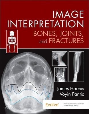 Image Interpretation: Bones, Joints, and Fractures by Harcus, James
