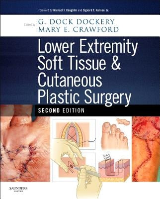 Lower Extremity Soft Tissue & Cutaneous Plastic Surgery by Dockery, G. Dock