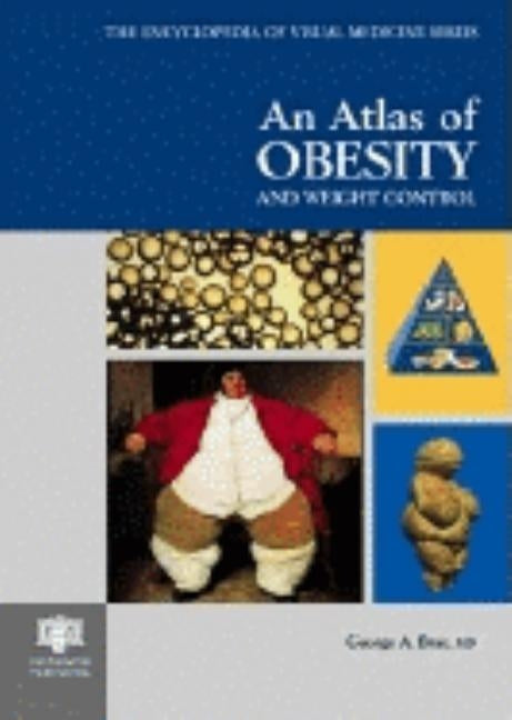 An Atlas of Obesity and Weight Control by Bray, George A.