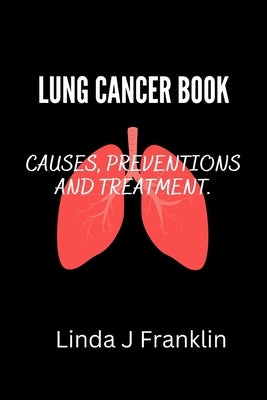 Lung Cancer Book: Causes, preventions and treatment by Franklin, Linda J.