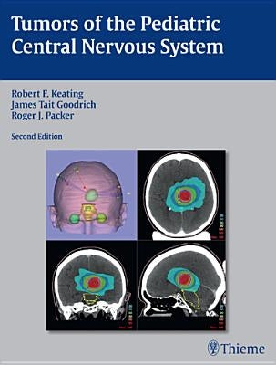 Tumors of the Pediatric Central Nervous System by Keating, Robert F.
