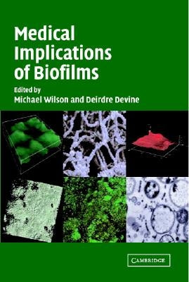 Medical Implications of Biofilms by Wilson, Michael