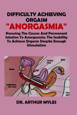 Difficulty Achieving Orgasm "Anorgasmia": Knowing The Causes And Permanent Solution To Anorgasmia, The Inability To Achieve Orgasm Despite Enough Stim by Myles, Arthur