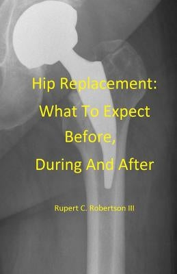 Hip Replacement: What To Expect Before, During and After by Robertson, Rupert C.