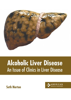 Alcoholic Liver Disease: An Issue of Clinics in Liver Disease by Norton, Seth