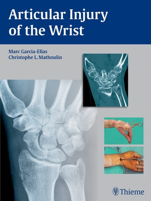 Articular Injury of the Wrist: Fessh 2014 Instructional Course Book by Garcia-Elias, Marc