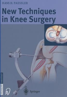 New Techniques in Knee Surgery by Paessler, H. H.