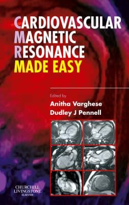 Cardiovascular Magnetic Resonance Made Easy by Varghese, Anitha