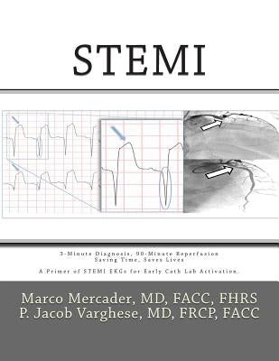 Stemi: 3-Minute Diagnosis, 90-Minute Reperfusion: Saving Time, Saves Lives by Varghese, P. Jacob