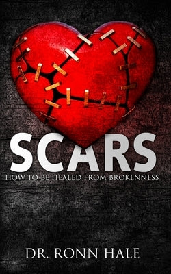 Scars: How to Be Healed from Brokenness by Hale, Ronn