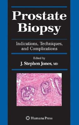 Prostate Biopsy: Indications, Techniques, and Complications by Jones, J. Stephen