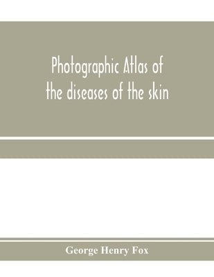 Photographic atlas of the diseases of the skin; A Series of Eighty Plates, Comprising more than One Hundred Illustrations, with Descriptive text, and by Henry Fox, George