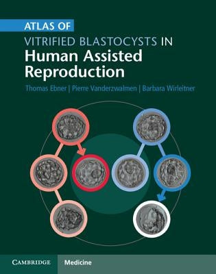 Atlas of Vitrified Blastocysts in Human Assisted Reproduction by Ebner, Thomas
