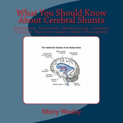 What You Should Know About Cerebral Shunts: Definition, Infection, Obstructions, Common Diseases that may require Shunt Placements by Wesley, Misty Lynn