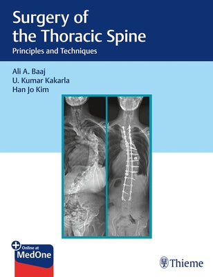 Surgery of the Thoracic Spine: Principles and Techniques by Baaj, Ali A.