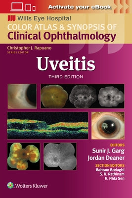 Uveitis by Garg, Sunir J.