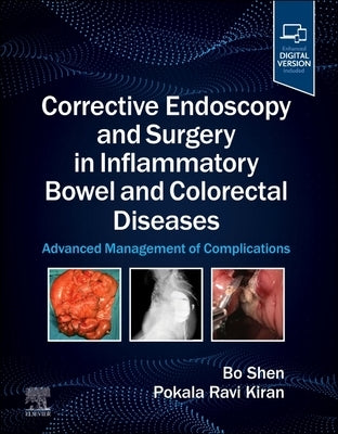 Corrective Endoscopy and Surgery in Inflammatory Bowel and Colorectal Diseases: Advanced Management of Complications by Shen, Bo