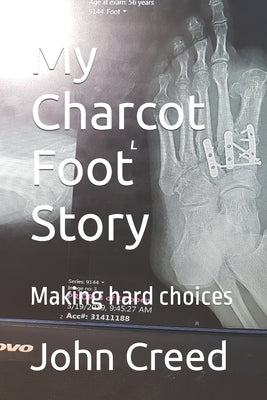 My Charcot Foot Story: Making hard choices by Creed, John