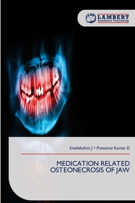 Medication Related Osteonecrosis of Jaw by J, Sreelekshmi