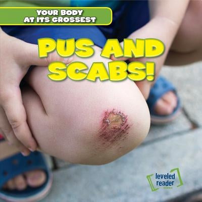 Pus and Scabs! by Hightower, Melvin