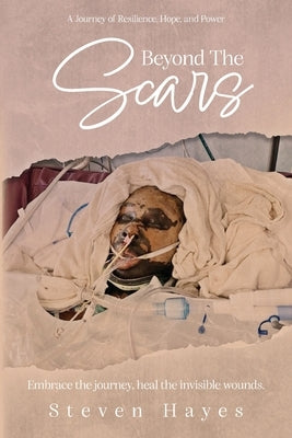 Beyond The Scars: A Journey of Resilience, Hope, and Power by Hayes, Steven