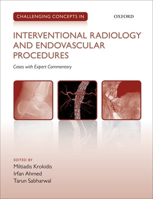 Challenging Concepts in Interventional Radiology by Krokidis, Miltiadis