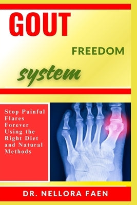 Gout Freedom System: Stop Painful Flares Forever Using the Right Diet and Natural Methods by Faen, Nellora