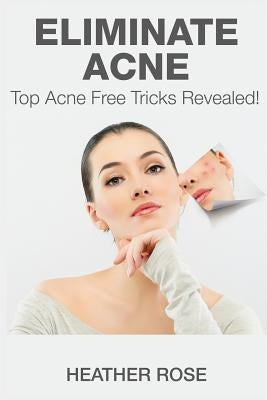 Eliminate Acne: Top Acne Free Tricks Revealed! by Rose, Heather