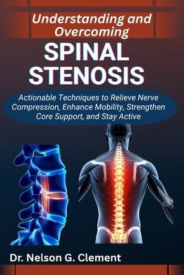 Understanding and Overcoming Spinal Stenosis: Actionable Techniques to Relieve Nerve Compression, Enhance Mobility, Strengthen Core Support, and Stay by G. Clement, Nelson