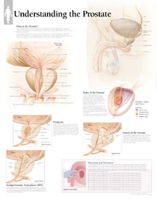 Understanding the Prostate: Laminated Wall Chart by Scientific Publishing