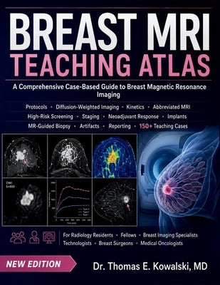 Breast MRI Teaching Atlas: A Comprehensive Case-Based Guide to Breast Magnetic Resonance Imaging by E. Kowalski, Thomas