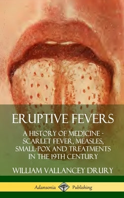Eruptive Fevers: A History of Medicine - Scarlet Fever, Measles, Small-Pox and Treatments in the 19th Century (Hardcover) by Drury, William Vallancey