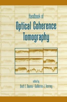 Handbook of Optical Coherence Tomography by Bouma, Brett