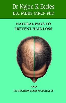 Natural Ways to Prevent Hair Loss: How to regrow hair naturally by Eccles, Nyjon K.