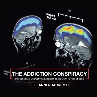 The Addiction Conspiracy: Unlocking Brain Chemistry and Addiction so You Don't Have to Struggle by Tannenbaum, Lee
