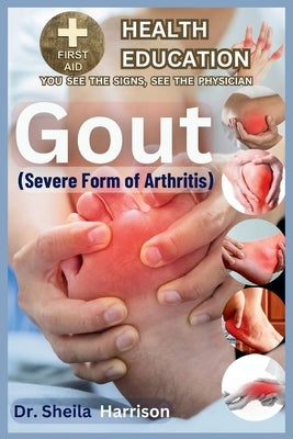 Gout: Severe Form of Arthritis: Causes, Symptoms, Risk Modifiers Management, Treatment, MEDICATIONS(APPROVED BY ADA), Preven by Harrison, Sheila