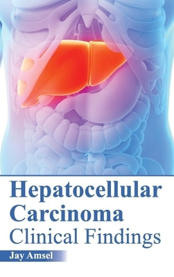 Hepatocellular Carcinoma: Clinical Findings by Amsel, Jay