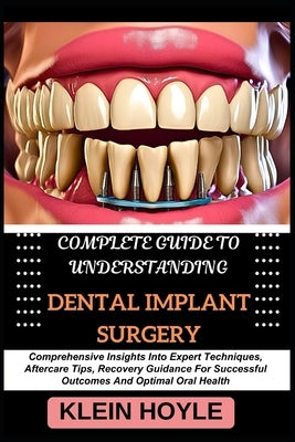 Complete Guide to Understanding Dental Implant Surgery: Comprehensive Insights Into Expert Techniques, Aftercare Tips, Recovery Guidance For Successfu by Hoyle, Klein