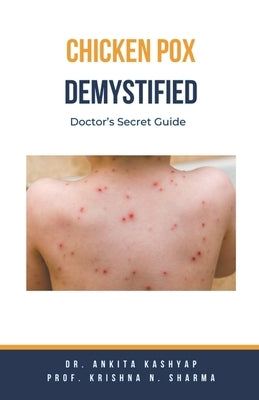Chickenpox Demystified: Doctor's Secret Guide by Kashyap, Ankita