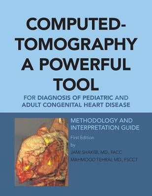 Computed-Tomography a Powerful Tool for Diagnosis of Pediatric and Adult Congenital Heart Disease: Methodology and Interpretation Guide by Shakibi, Facc