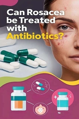 Can Rosacea Be Treated with Antibiotics?: Antibiotics can often be effective at treating rosacea symptoms in combination with lifestyle changes like a by Evalina, Recardim Smith