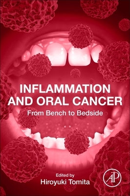 Inflammation and Oral Cancer: From Bench to Bedside by Tomita, Hiroyuki
