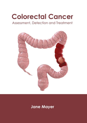 Colorectal Cancer: Assessment, Detection and Treatment by Mayer, Jane