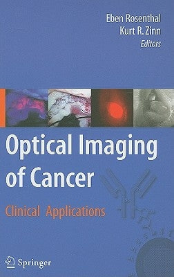 Optical Imaging of Cancer: Clinical Applications by Rosenthal, Eben