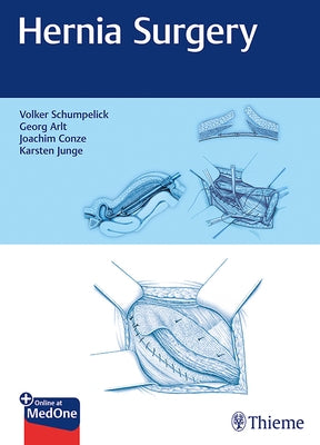 Hernia Surgery by Schumpelick, Volker