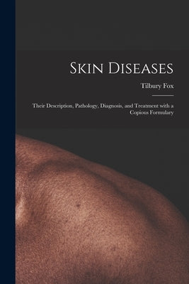 Skin Diseases [electronic Resource]: Their Description, Pathology, Diagnosis, and Treatment With a Copious Formulary by Fox, Tilbury 1836-1879